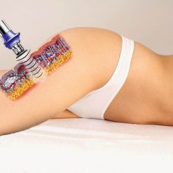 Anti-cellulite treatment