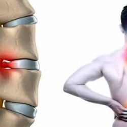 Back pain