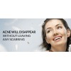 Serum Anti Acnee ACNEVIT